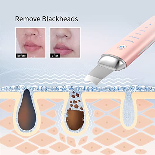 מרית עור Cosbeauty Scrubber, 4 ב 1 מכשיר טיפוח לעור מגוונת לפילינג | כלי מסיר Blackhead | עוזר